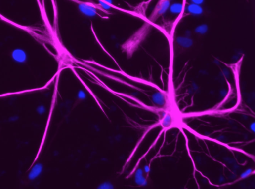 image of neurons from Corneilson Group
