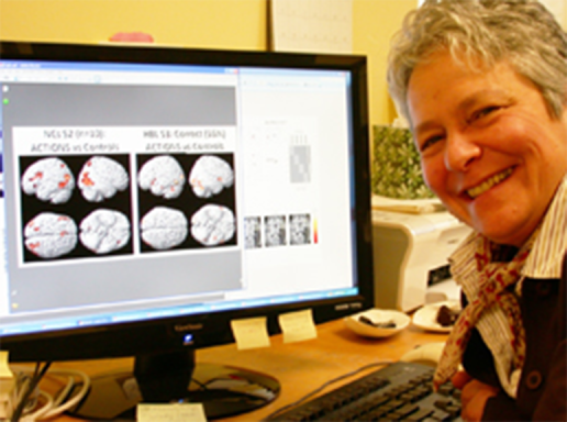 Jacquie Kurland next to a laptop with an MRI image